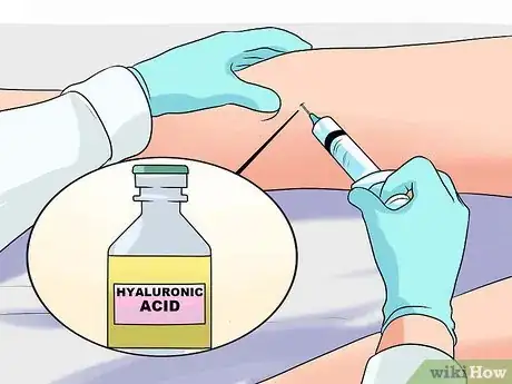 Image titled Treat Post Traumatic Arthritis Step 9