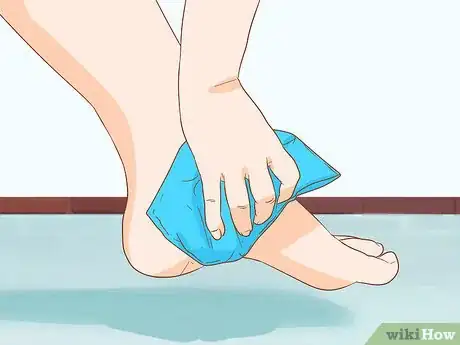 Image titled Treat a Blood Blister Step 2