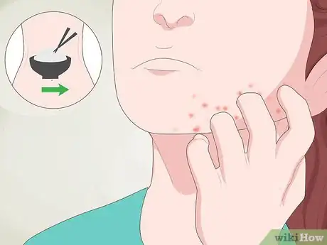 Image titled Diagnose Food Intolerance Step 1