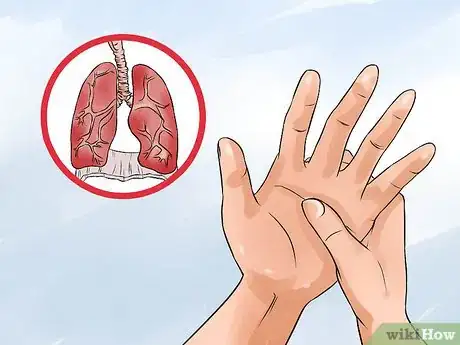 Image titled Read a Hand Reflexology Chart Step 6