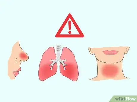 Image titled Diagnose the Flu Step 6