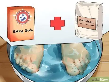 Image titled Reduce Eczema Itching Step 6