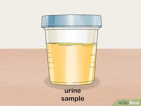 Image titled Diagnose Multiple Myeloma Step 8