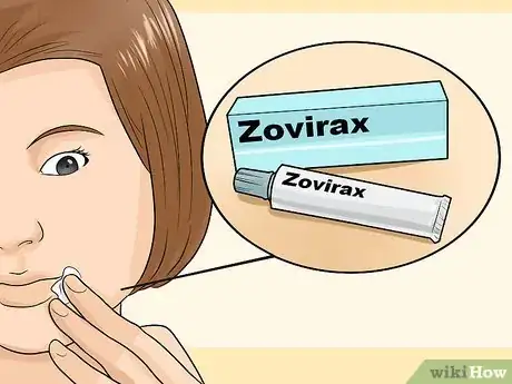 Image titled Recognize Herpes Step 8