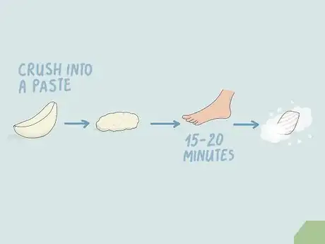 Image titled Heal Skin Naturally Step 12