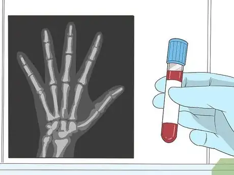 Image titled Treat Rheumatism Step 3