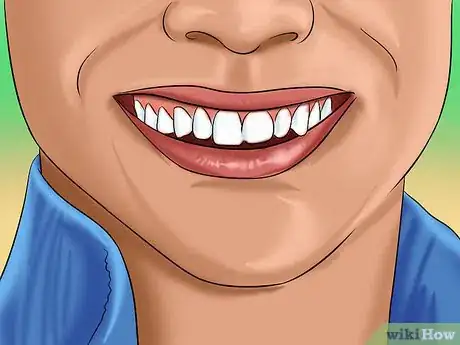 Image titled Find Happiness After a Traumatic Brain Injury Step 1