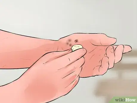 Image titled Use Lemon Juice in Your Beauty Routine Step 9