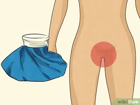 Image titled Deal with Soreness After Sex Step 8