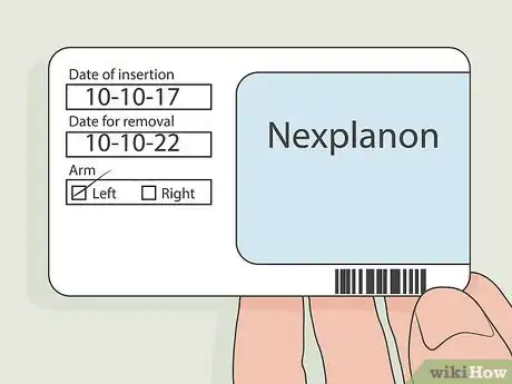 Image titled Remove Nexplanon Step 1