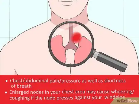 Image titled Diagnose Castleman Disease Step 2