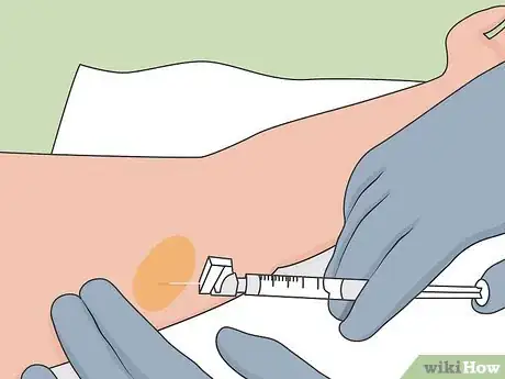Image titled Remove Nexplanon Step 7
