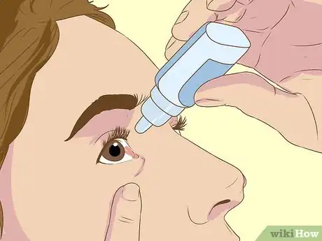Image titled Diagnose Surfer's Eye Step 7
