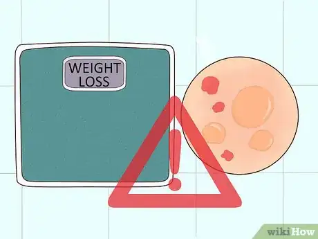 Image titled Diagnose Castleman Disease Step 4