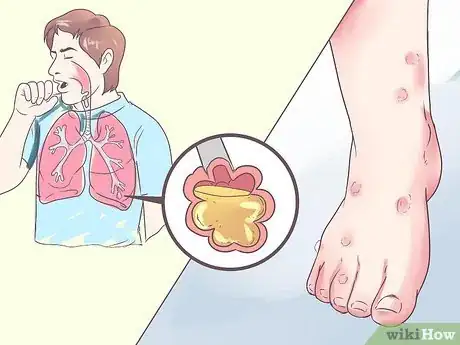 Image titled 229963 2