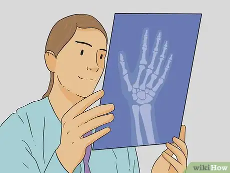 Image titled Diagnose a Broken Thumb Step 11