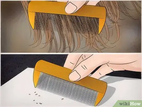 Image titled Free Your Child from Lice Step 10
