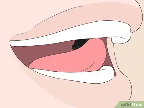 Image titled Serve Caviar Step 18