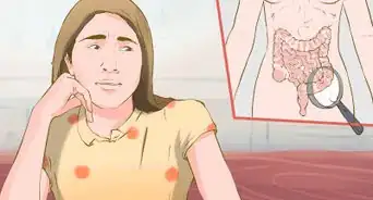 Manage Ulcerative Colitis