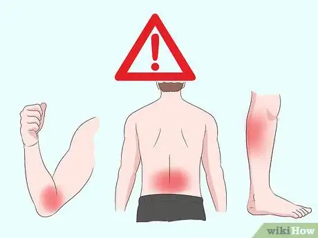 Image titled Diagnose the Flu Step 5