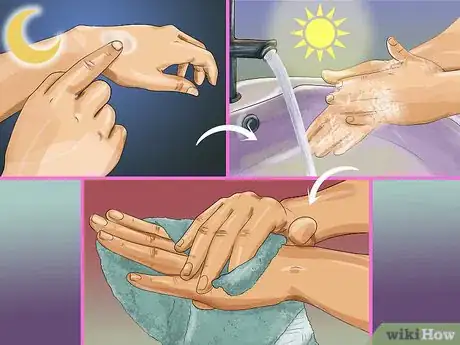 Image titled Pumice a Wart Step 7