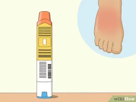 Image titled Treat Mast Cell Activation Syndrome Step 10