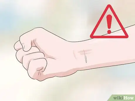 Image titled Know if Your Emotions Are Hurting Your Health Step 2