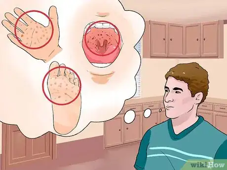 Image titled Protect Kids from Hand Foot and Mouth Disease Step 9