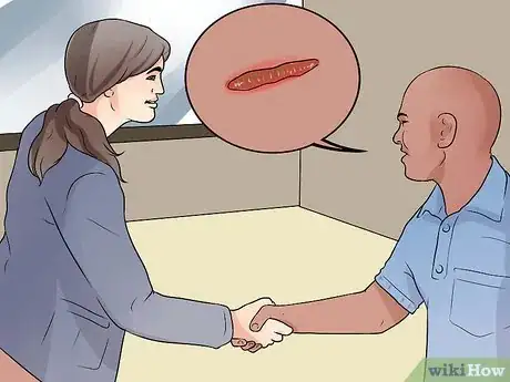 Image titled Prevent Keloid and Hypertrophic Scars Step 3