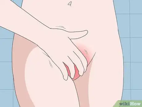 Image titled Prevent Trichomoniasis Step 8