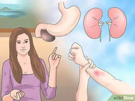 Image titled Spot Distributive Shock Symptoms Step 10