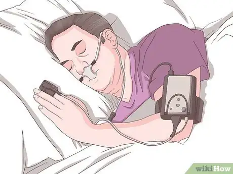 Image titled Undergo Somnoplasty Step 1