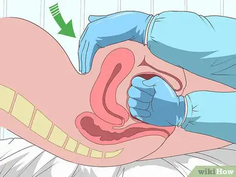 Image titled Prevent and Treat Postpartum Hemorrhage Step 13