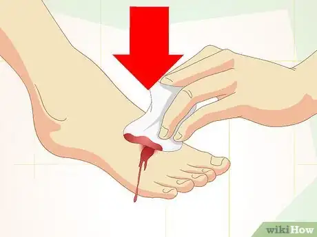 Image titled Care for Superficial Wounds Step 14