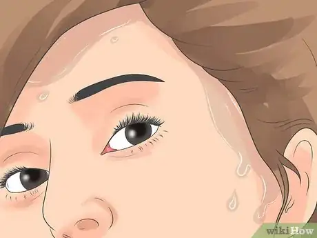 Image titled Treat Cystic Acne Naturally Step 17