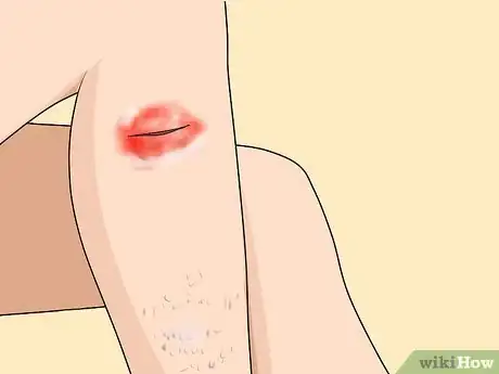 Image titled Know if You Have Sensitive Skin Step 8