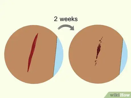 Image titled Find Out if You Have a Vitamin Deficiency Step 7