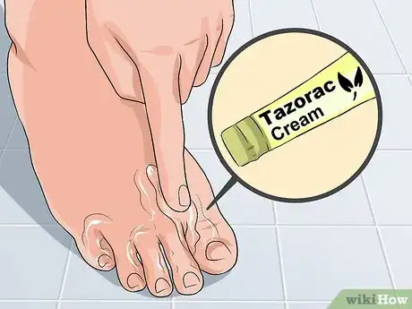 Image titled Avoid Psoriasis Vaccine Complications Step 10