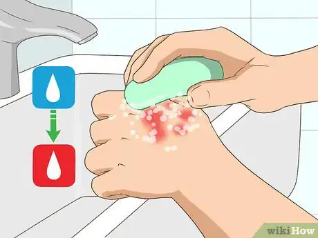 Image titled Heal Red Skin Step 1