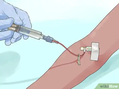 Image titled Diagnose Hemophilia Step 7