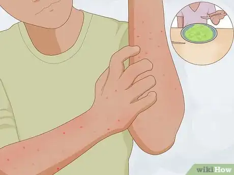 Image titled Diagnose Food Intolerance Step 5