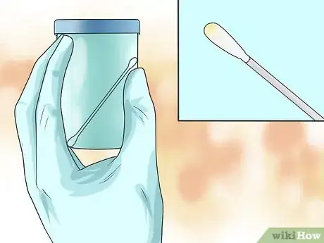 Image titled Take a Throat Culture Step 8