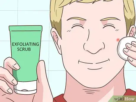 Image titled Get Rid of a Pimple Step 6