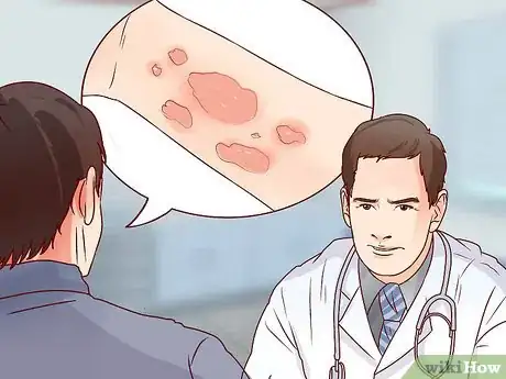 Image titled Recognize Hives (Rash) Step 8