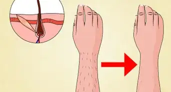 Get the Most Benefit from Laser Hair Removal