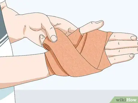 Image titled Wrap a Sprained Thumb Step 7
