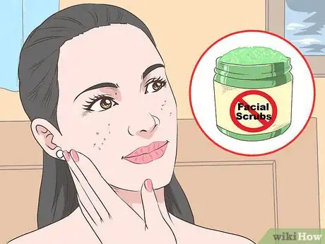 Image titled Stop Acne Reinfection Step 3
