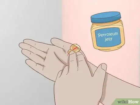 Image titled Heal Cuts Step 6