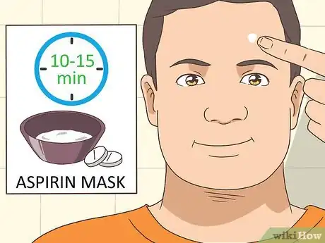 Image titled Get Rid of a Pimple Step 8