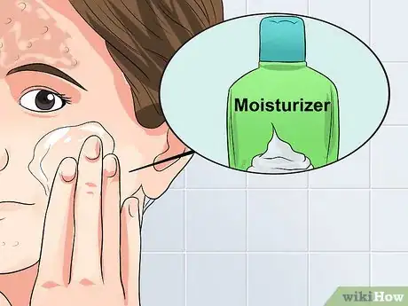 Image titled Avoid Psoriasis Vaccine Complications Step 16